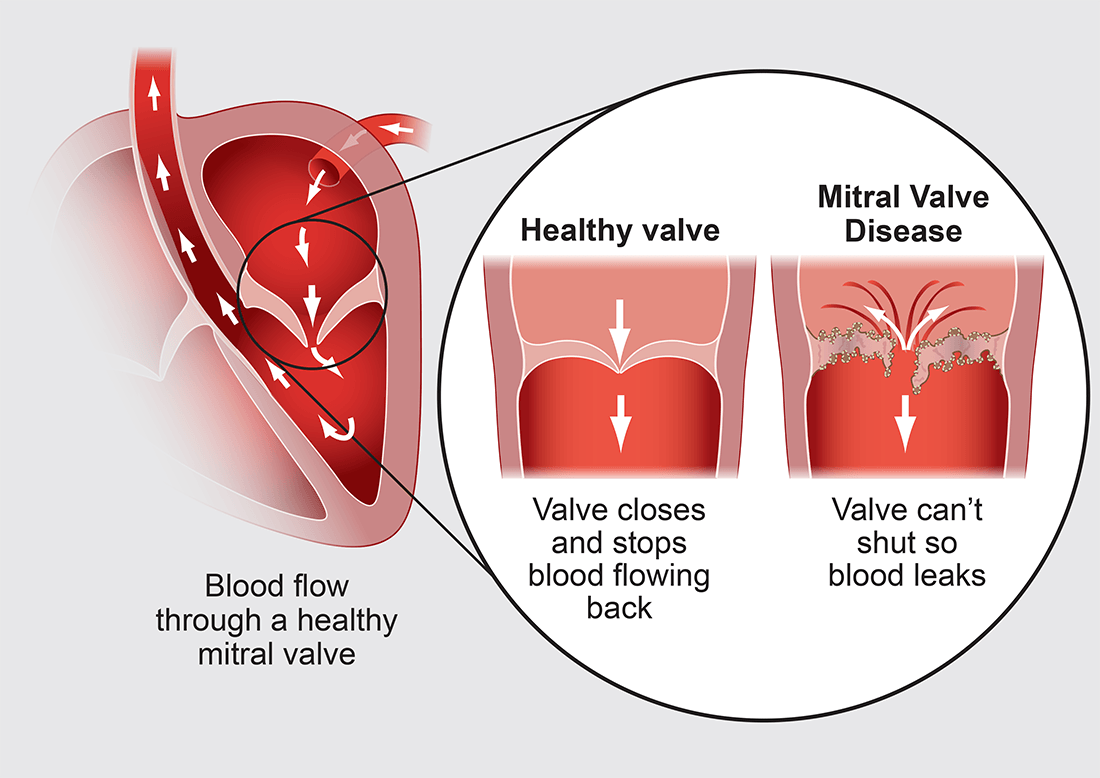 Mitral Valve Disease in Dogs - PDSA