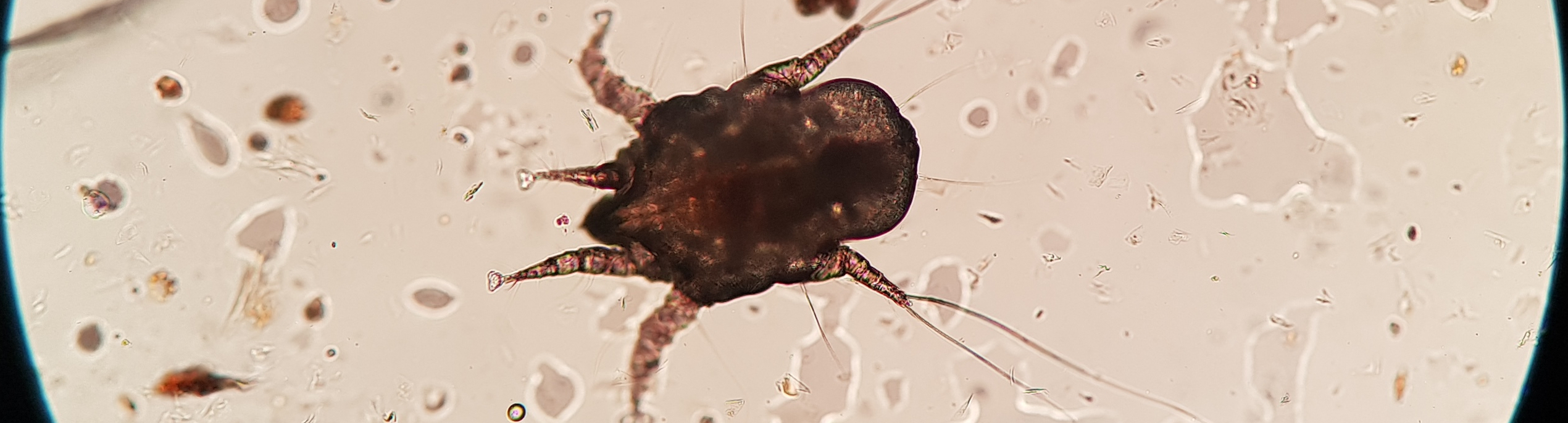 Microscopic image of ear mite