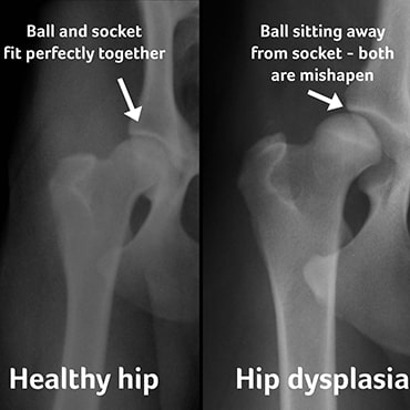 xrays showing healthy hip vs hip with dysplasia