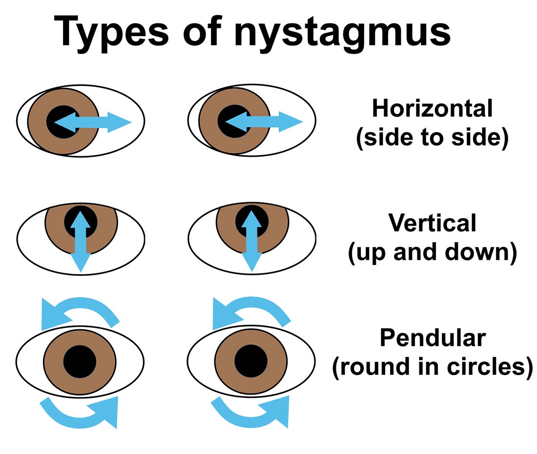 Nystagmus (flickering eye movements) in a dog - PDSA