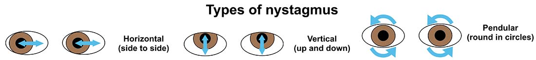 how to treat nystagmus in dogs